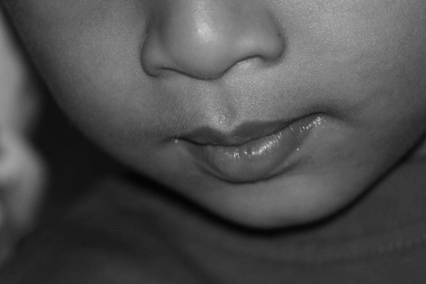 Philtrum