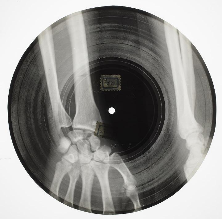 ¿Qué mejor uso para una radiografía?